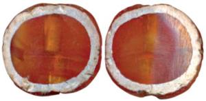 Eye bead (c. 3rd BC-3rd AD), Ancient Carnellian bead with white enamel etched on the edge 